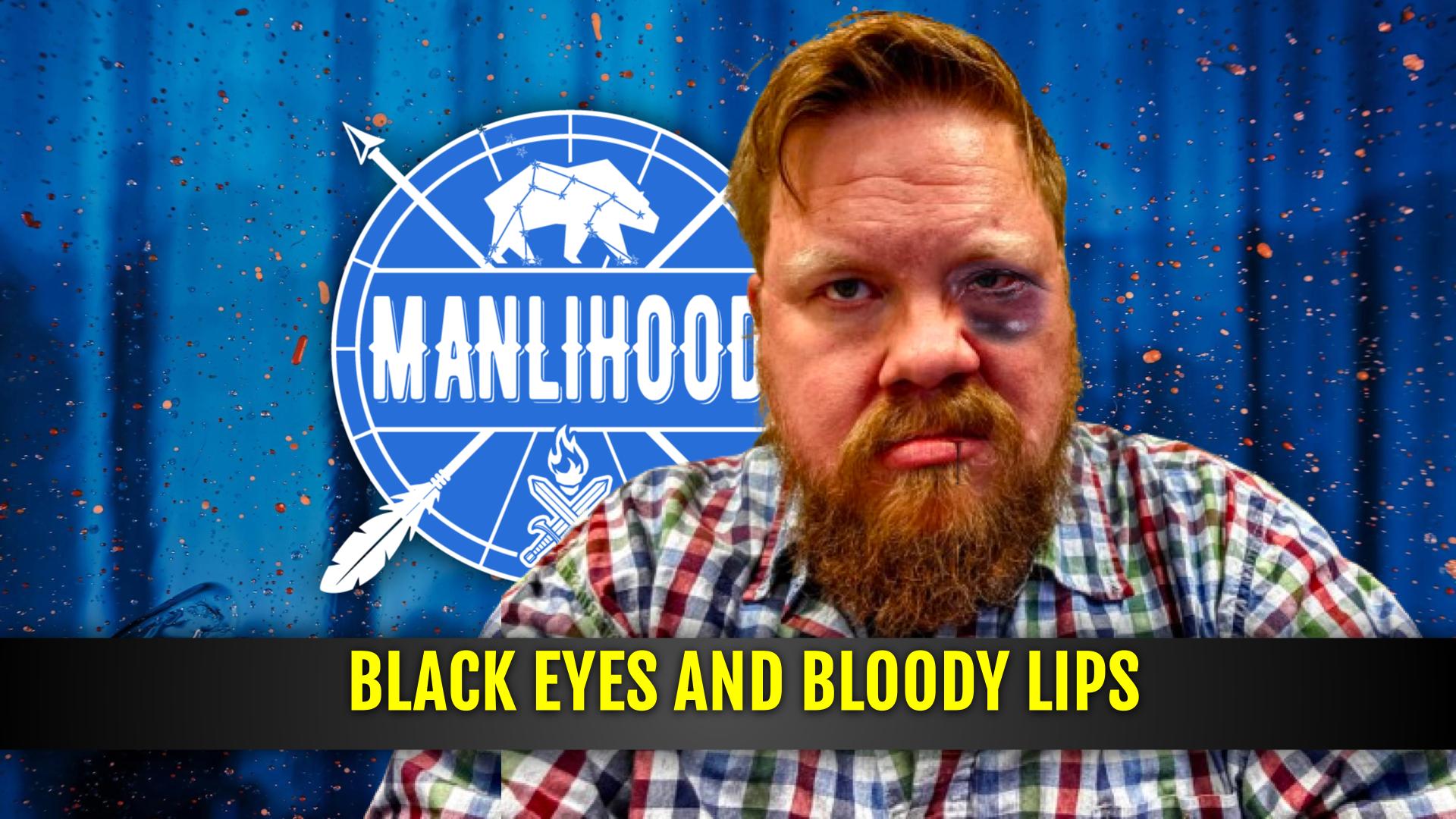 Black eyes and bloody lips | a podcast for men